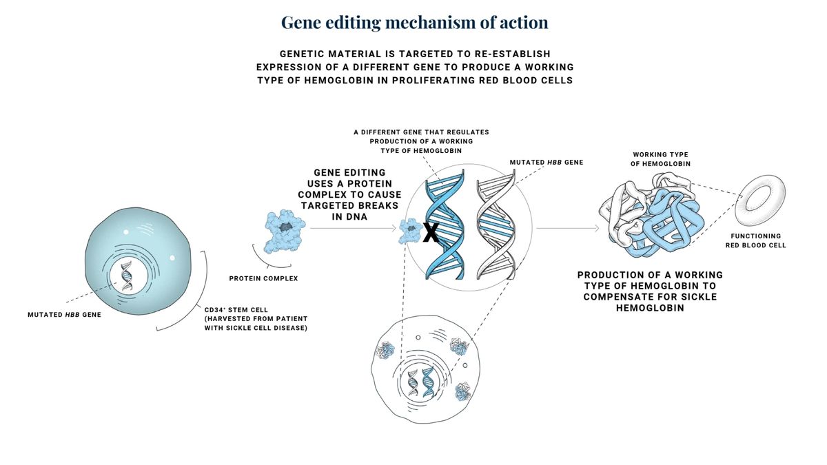The Future of Sickle Cell Disease Treatment: A Deep Dive Into Bluebird