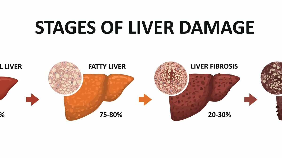 The Impact of Heavy Drinking on Health: From Gut Microbiome to Liver ...