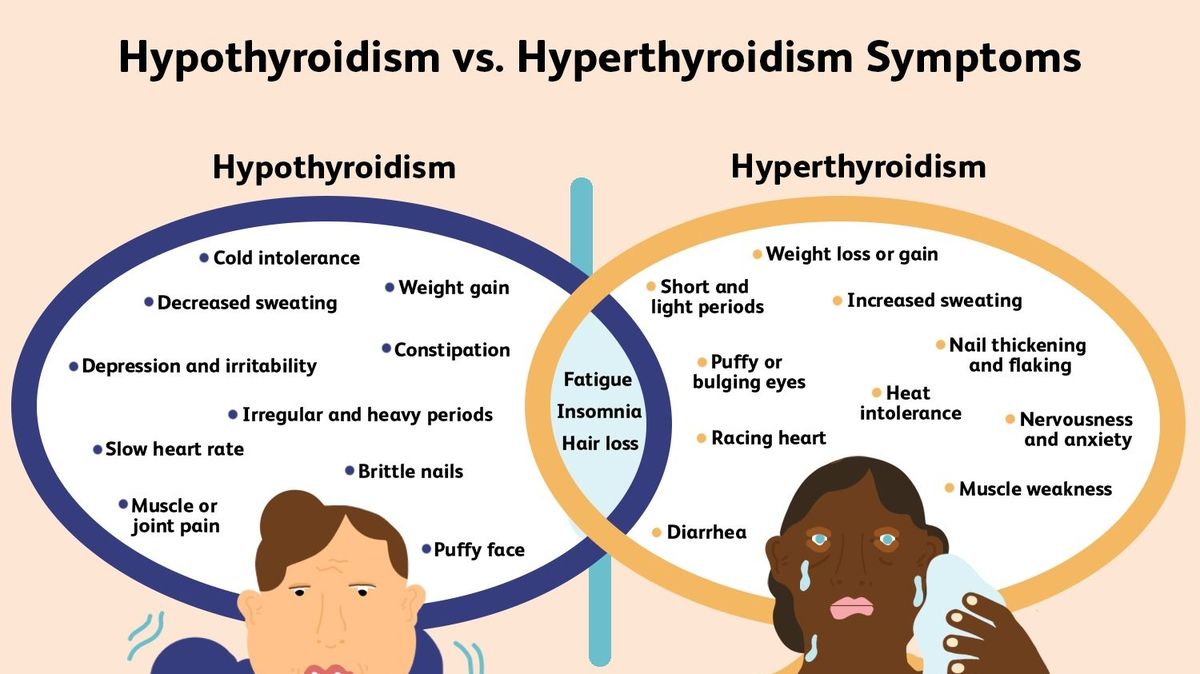 Understanding Hyperthyroidism Causes Symptoms And Treatment 