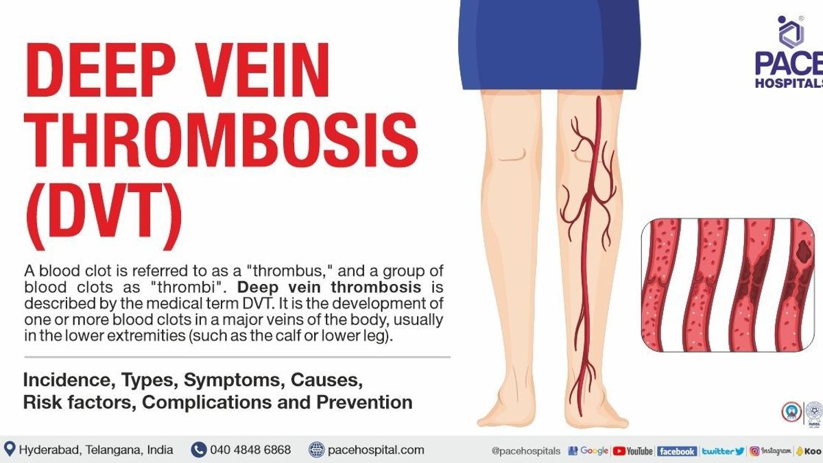 Unveiling the Lesser-Known Causes of Deep Vein Thrombosis (DVT): Why  Awareness Is Key