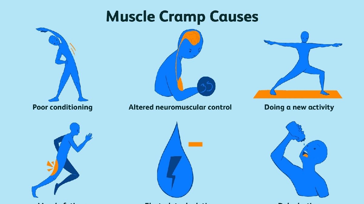 Understanding Muscle Twitches, Spasms, and Cramps Causes and Solutions