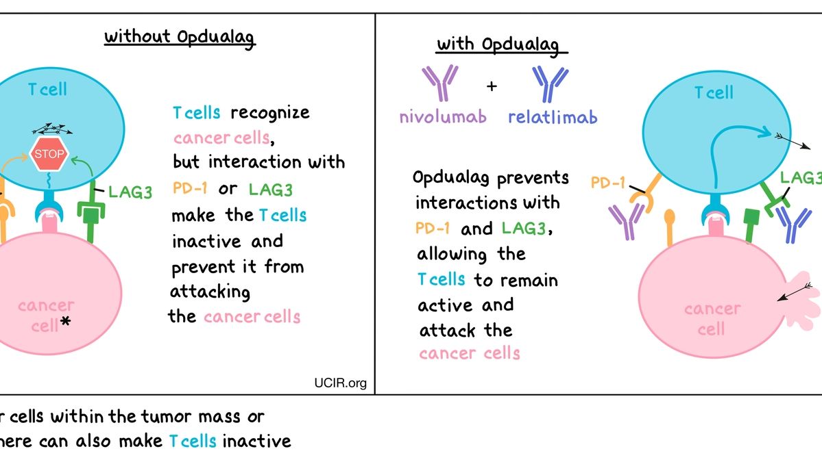 NICE Approves Nivolumab and Relatlimab Combination for Advanced