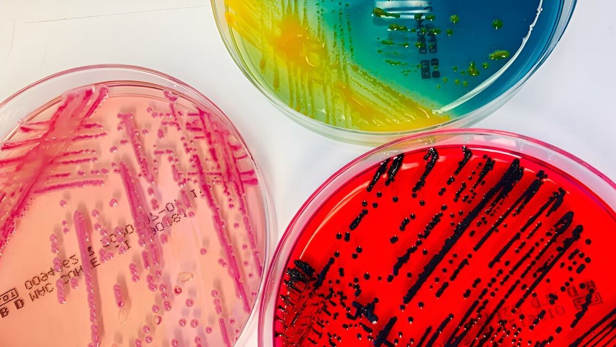 Groundbreaking Discovery of Unknown Bacteria Species in Hospitals ...