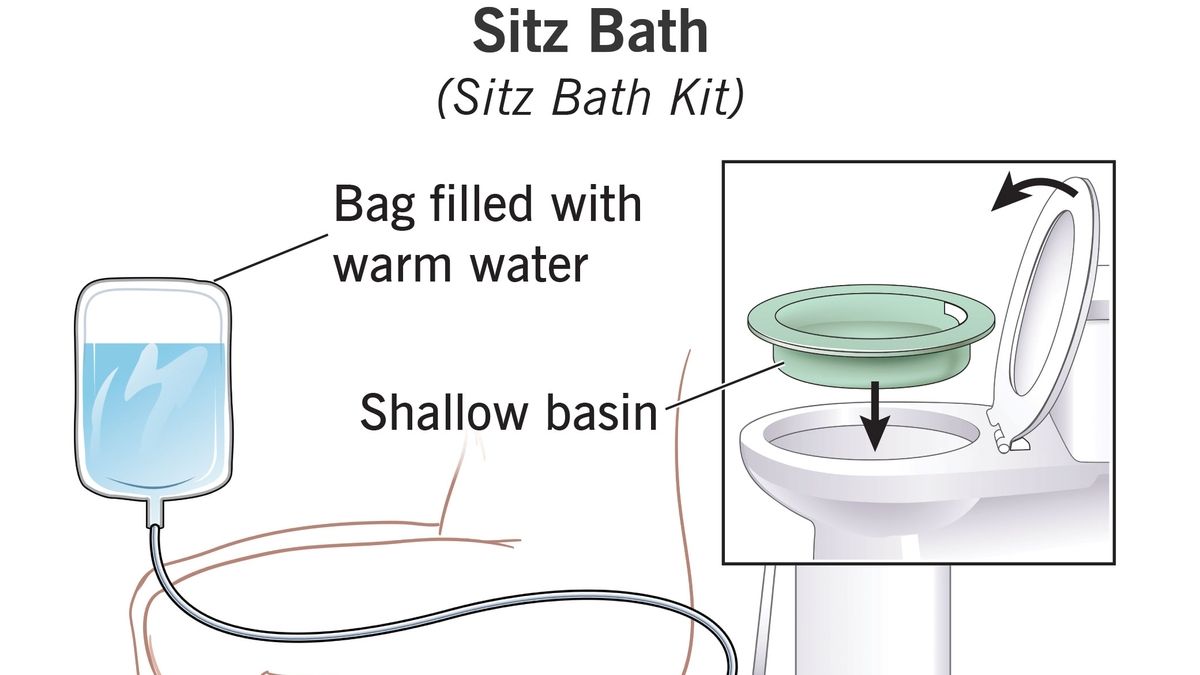The Healing Power of Sitz Baths Relief for Perineal and
