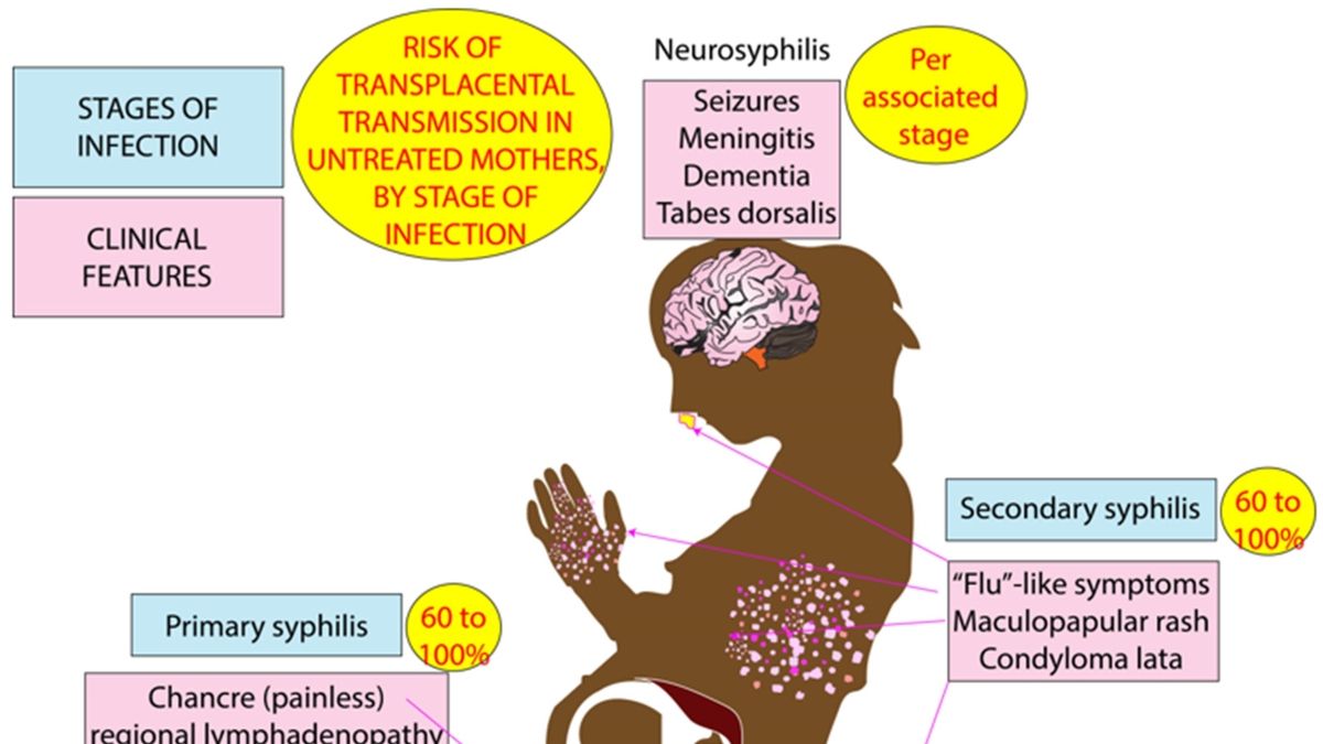 Syphilis In Pregnancy: Complications, Manifestations, And Management