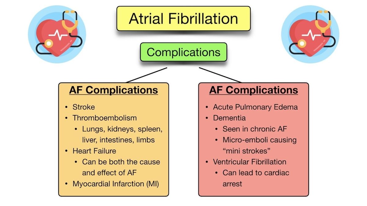 Understanding and Preventing Atrial Fibrillation: A Comprehensive Guide