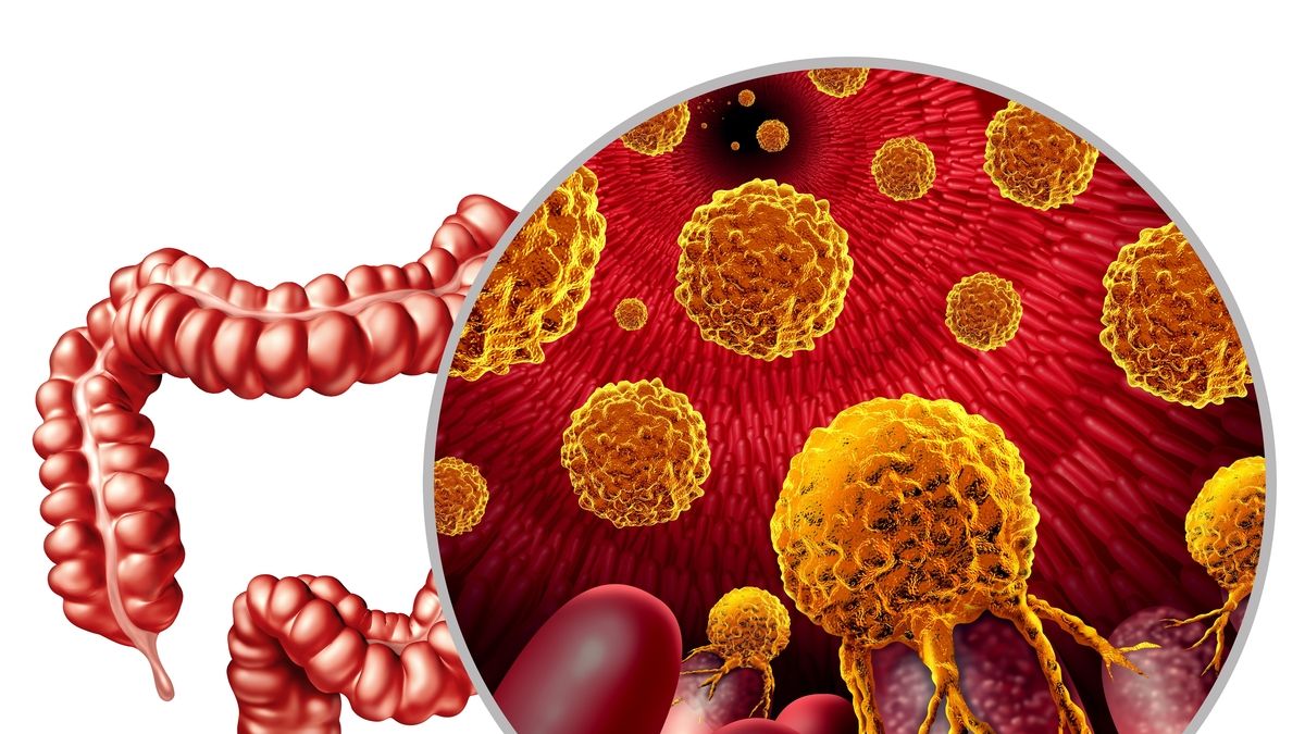 Gritstone Bio's Innovative Approach Towards a Neoantigen Cancer Vaccine