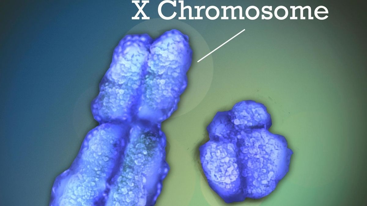 The Role of XChromosome Inactivation in Autoimmune Disorders A New