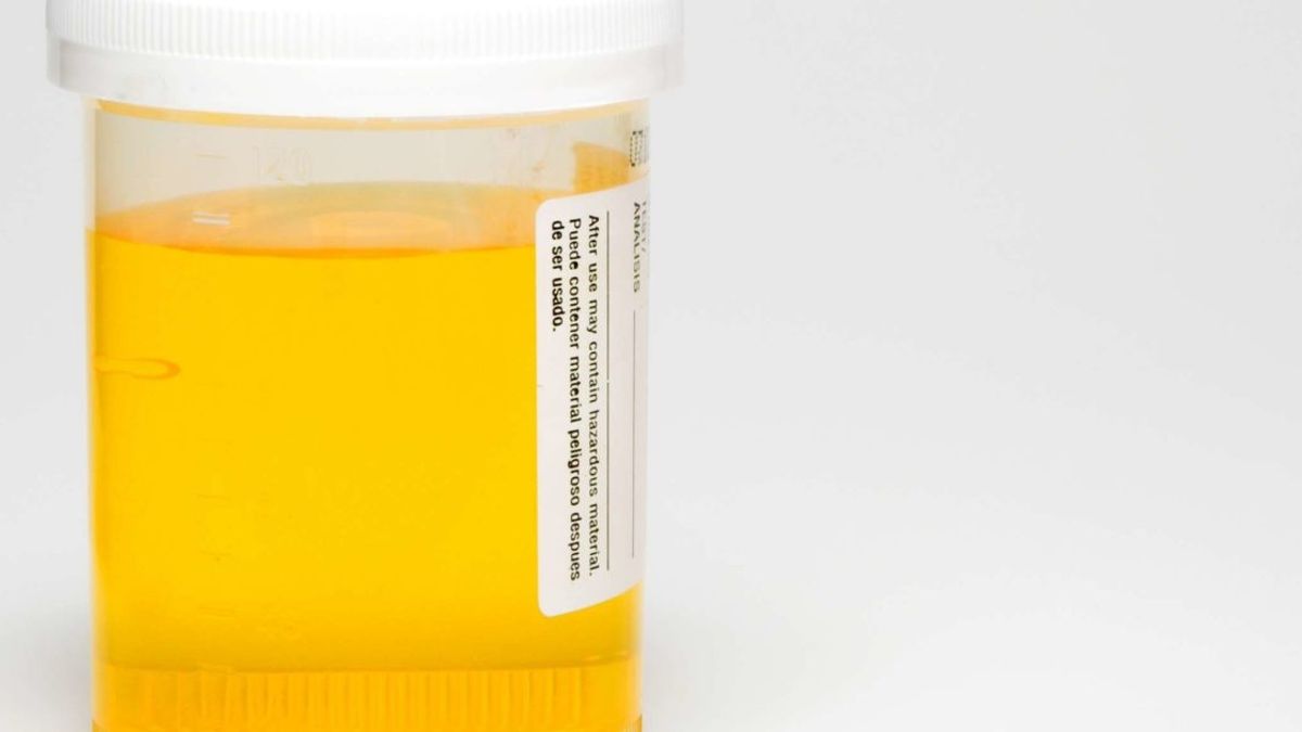 Understanding Your Health Through Urine Odor Insights and Practical Advice