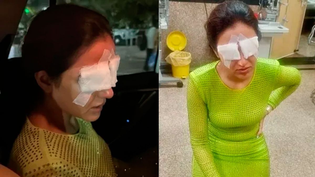 OMG! Actress Jasmin Bhasin Suffers Corneal Damage; Lens Mishap Leaves