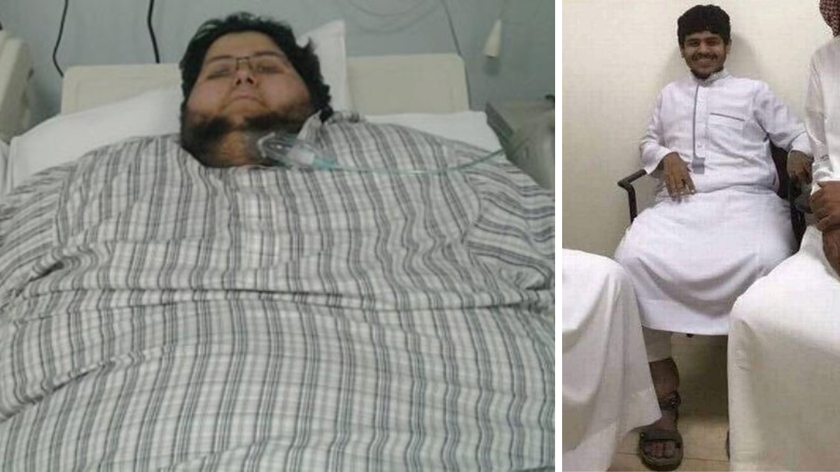 World's heaviest man alive loses 542kg. Here's how he went from 610kg ...