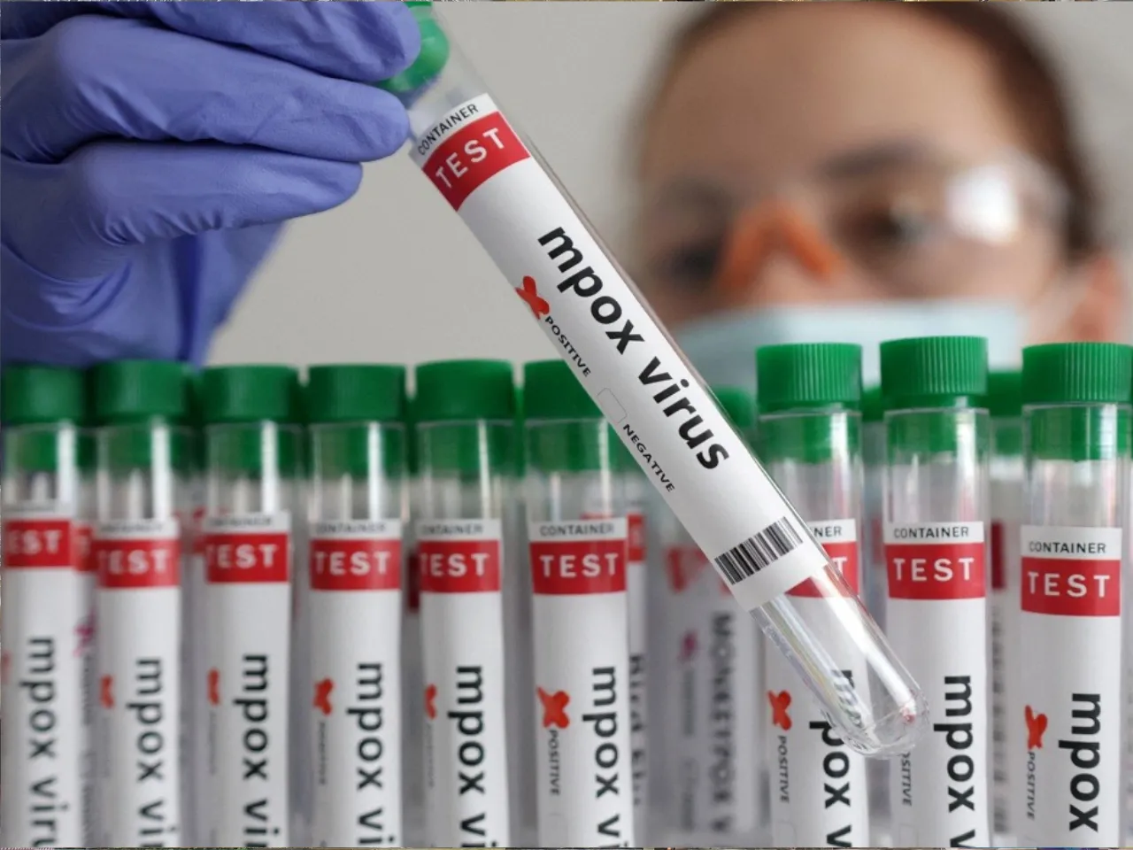 mpox in India 