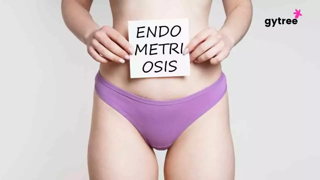 Methods of Endometriosis Treatment 