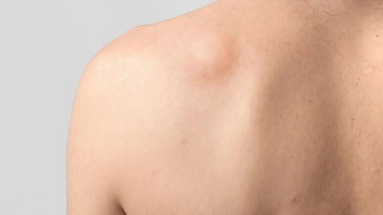 Symptoms Of Lumps In Women