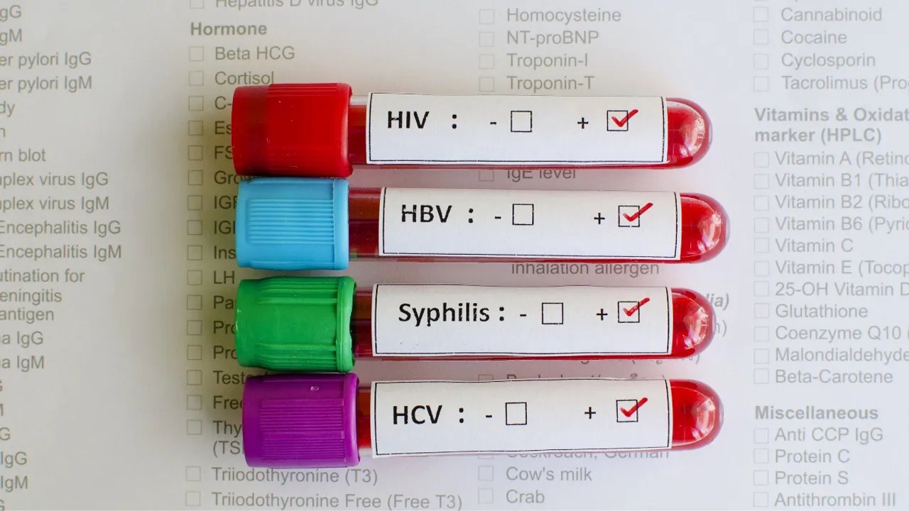 Hiv 