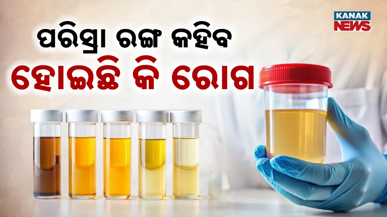  Urine  Photograph: (Kanak News) 
