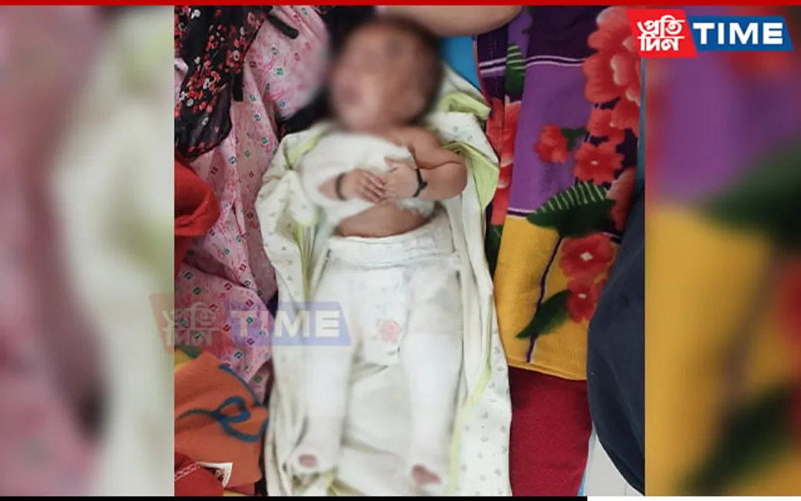 Guwahati: 5-Month-Old Baby Suffers Broken Arm, Legs at Hands Of Father