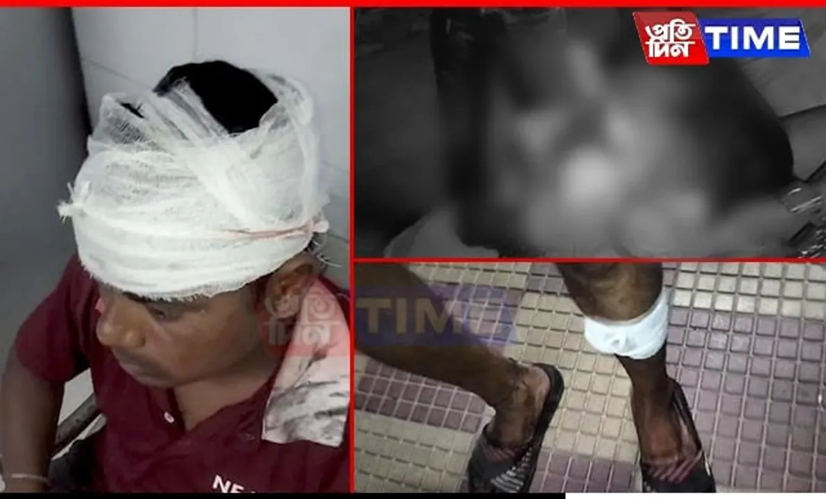 Scuffle Over Ganesh Idol Immersion Turns Brutal in Guwahati; Several Injured