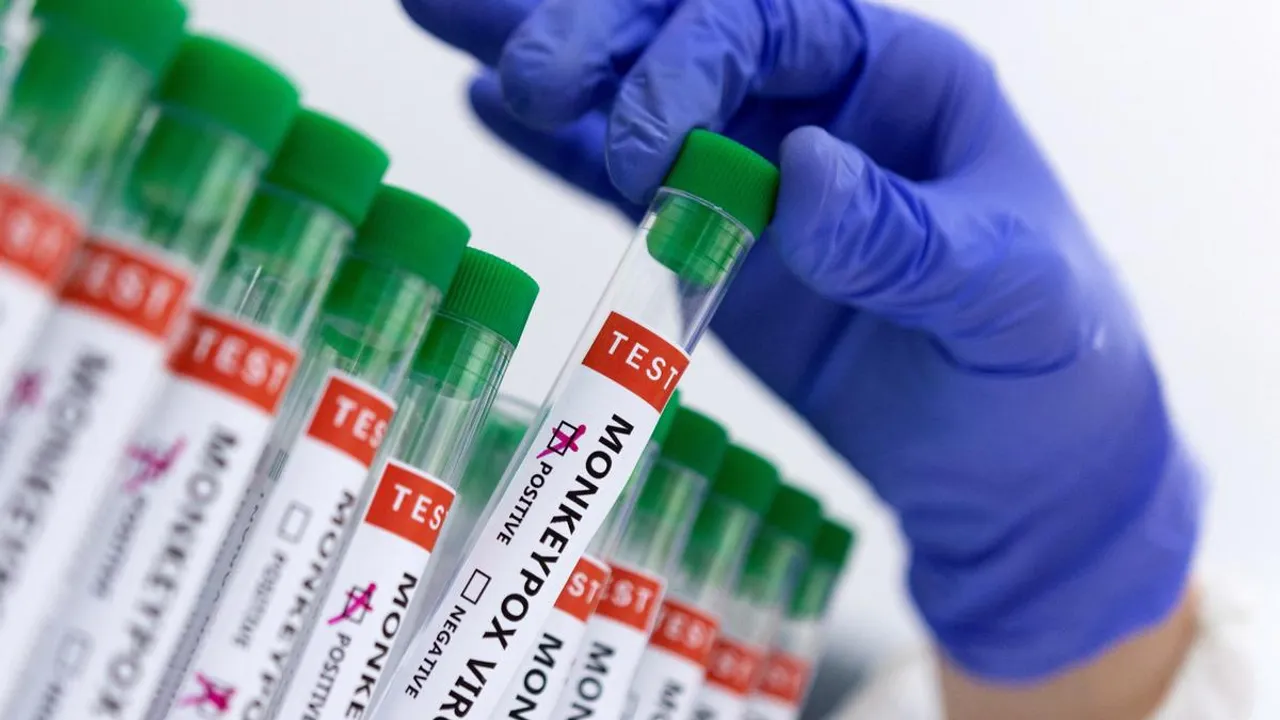 India's Second Mpox Case Detected in Kerala, Patient Isolated