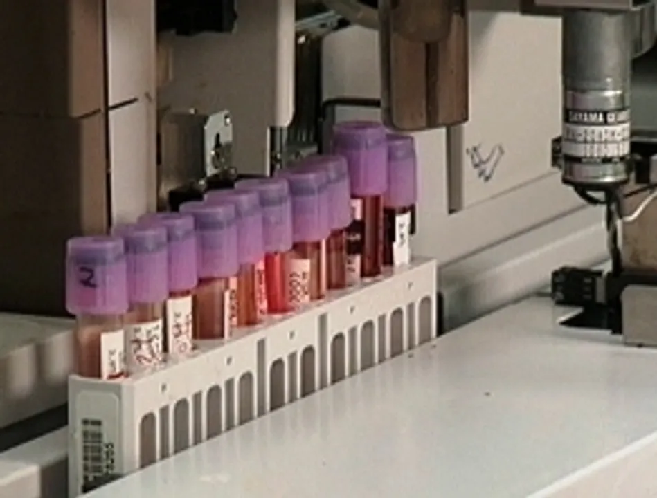  New blood test to help detect risk of 30 age-related diseases