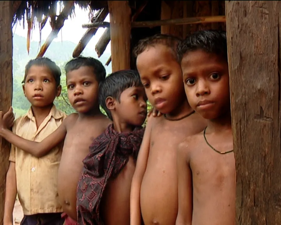  Malnutrition deaths: Central team to visit Odisha’s Nagada tomorrow