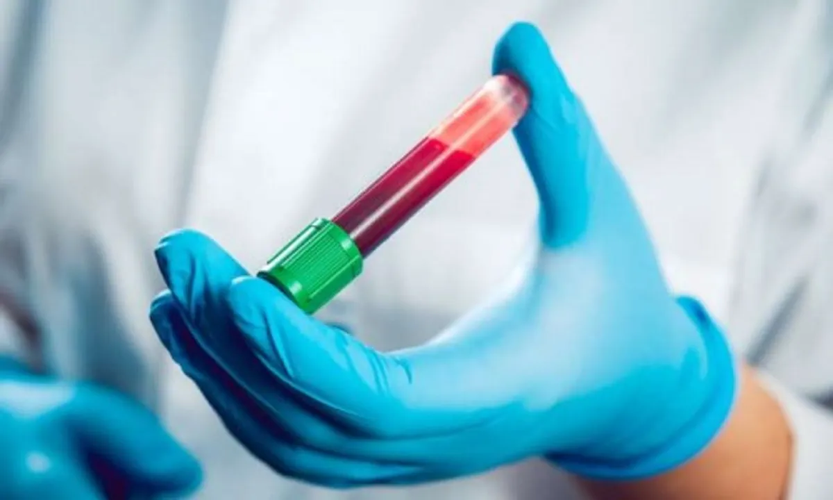  Blood test to predict risk of developing psychotic disorders