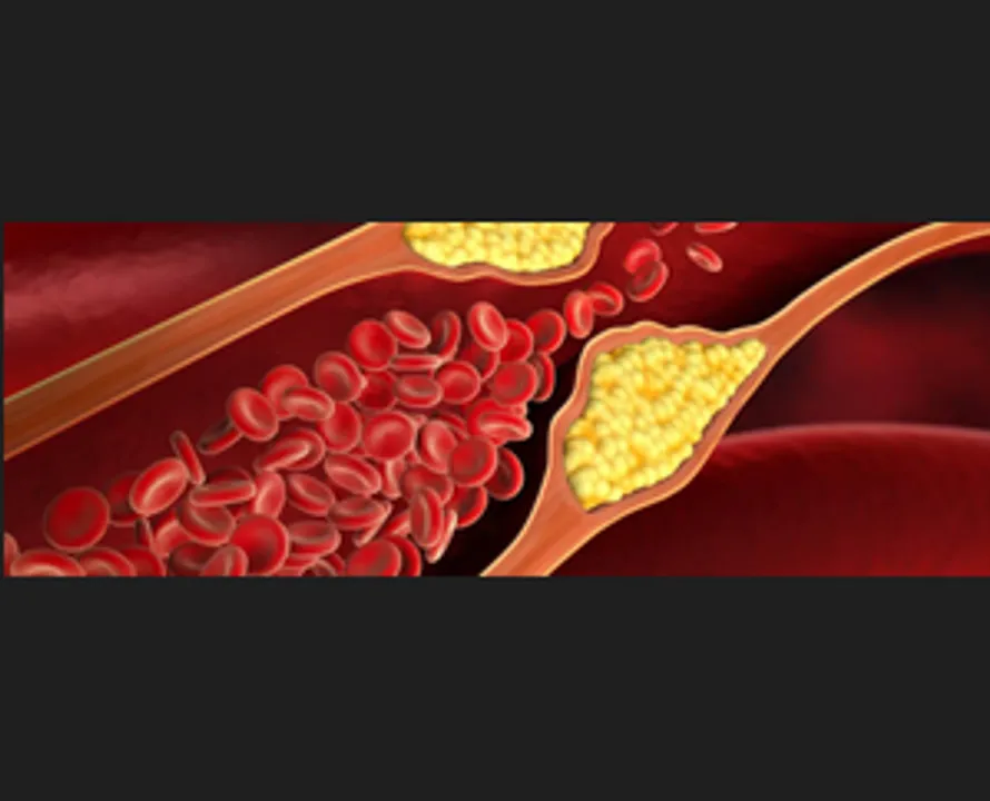  Indian researchers find a new, cheaper route to manage cholesterol