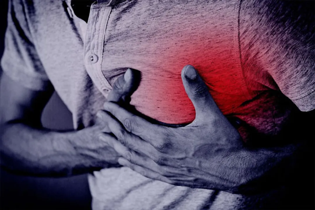  Study finds 80 pc microplastics in blood clots behind heart attack, stroke