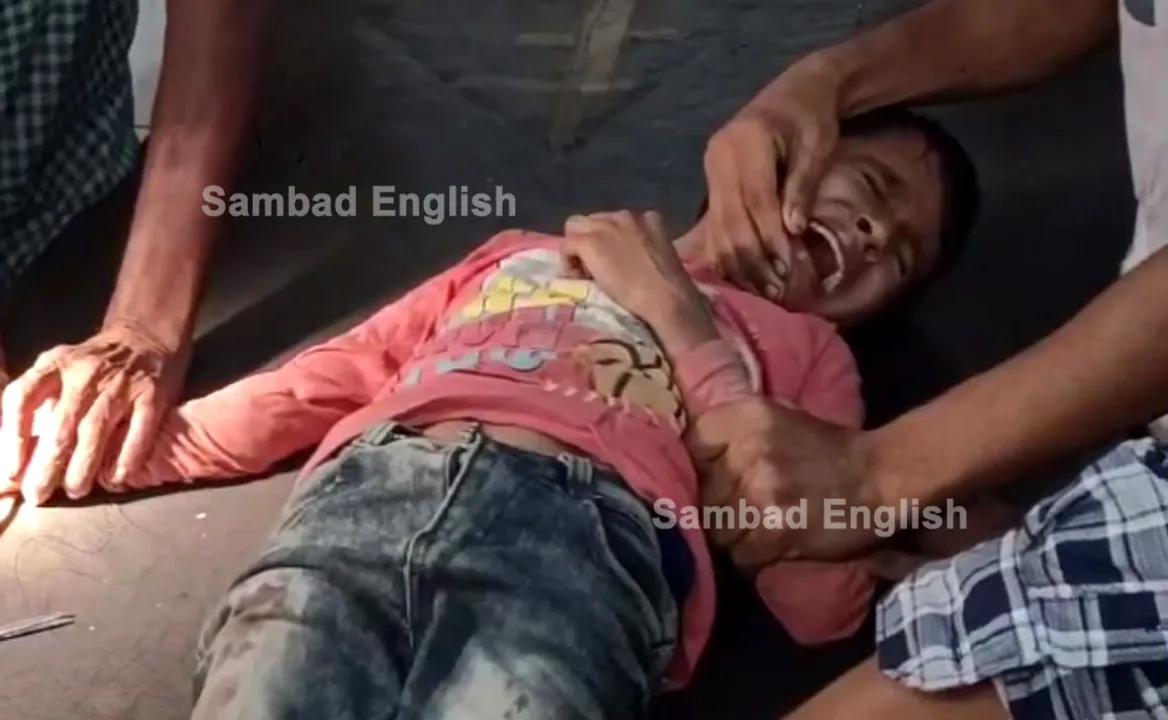  4 children injured while bursting firecracker on Diwali in Odisha’s Bhadrak; 3 critical