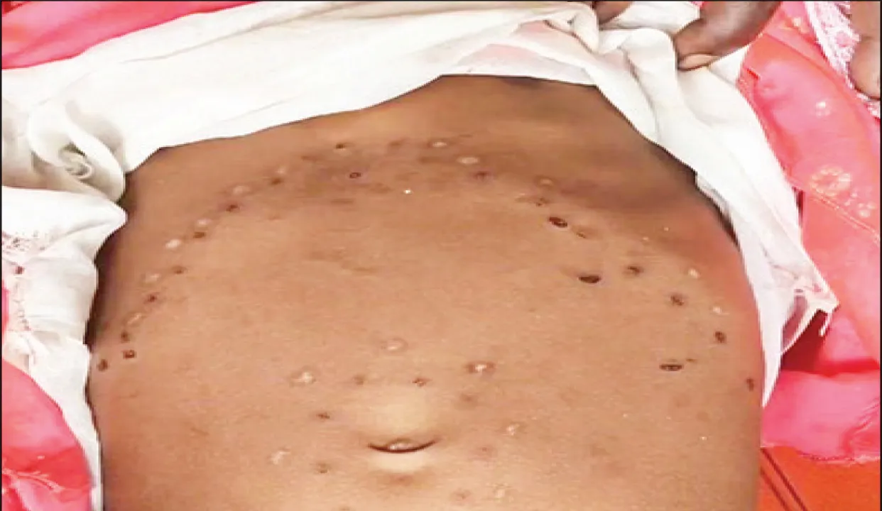  ଶିଶୁକନ୍ୟା ପେଟରେ ୬୦ ଚେଙ୍କ