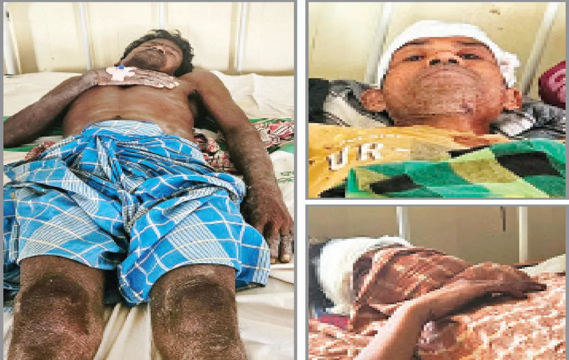  ବାଣ ବିସ୍ଫୋରଣରେ ଉଡ଼ିଗଲା ଛାତ, ଜଣେ ମୃତ, ୪ ଗୁରୁତର