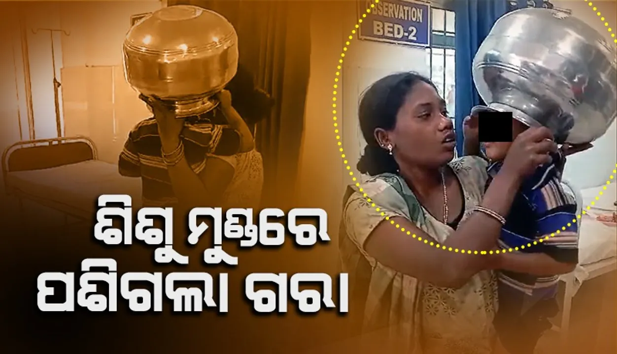 ଶିଶୁ ମୁଣ୍ଡରେ ପଶିଗଲା ଗରା: କଇଁଚି ଓ କଟର ସାହାଯ୍ୟରେ କଟାଗଲା ଗରା, ଶିଶୁ ସୁରକ୍ଷିତ