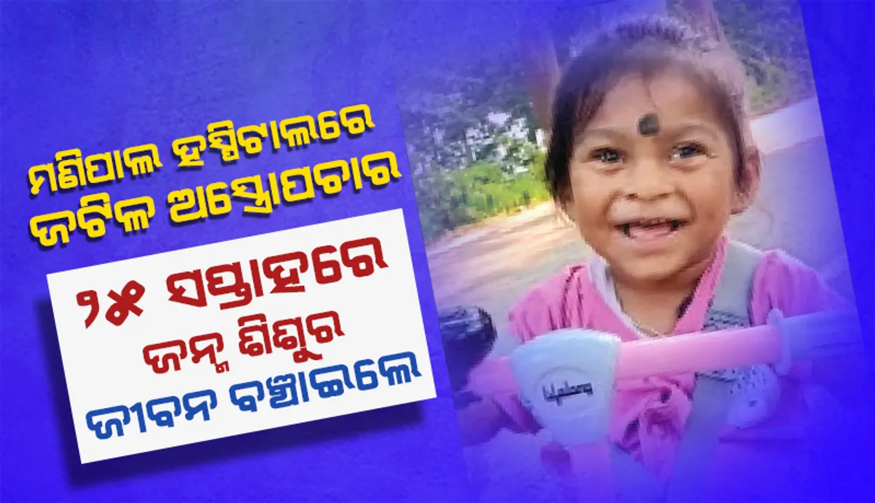  ମଣିପାଲ ହସ୍ପିଟାଲ୍‌ରେ ଜଟିଳ ଅସ୍ତ୍ରୋପଚାର: ୨୫ ସପ୍ତାହରେ ଜନ୍ମ ଶିଶୁର ଜୀବନ ବଞ୍ଚାଇଲେ