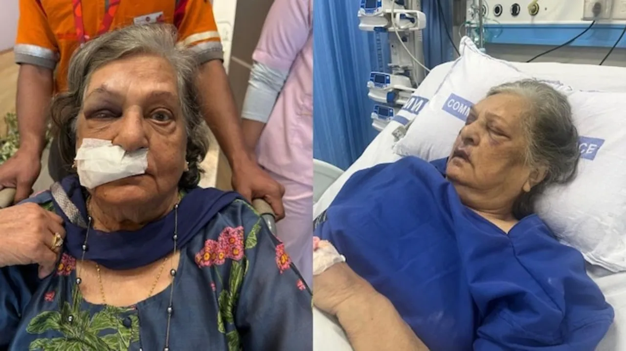 a-woman-claimed-that-her-grandmother-had-to-suffer-severe-injuries-after-air-india