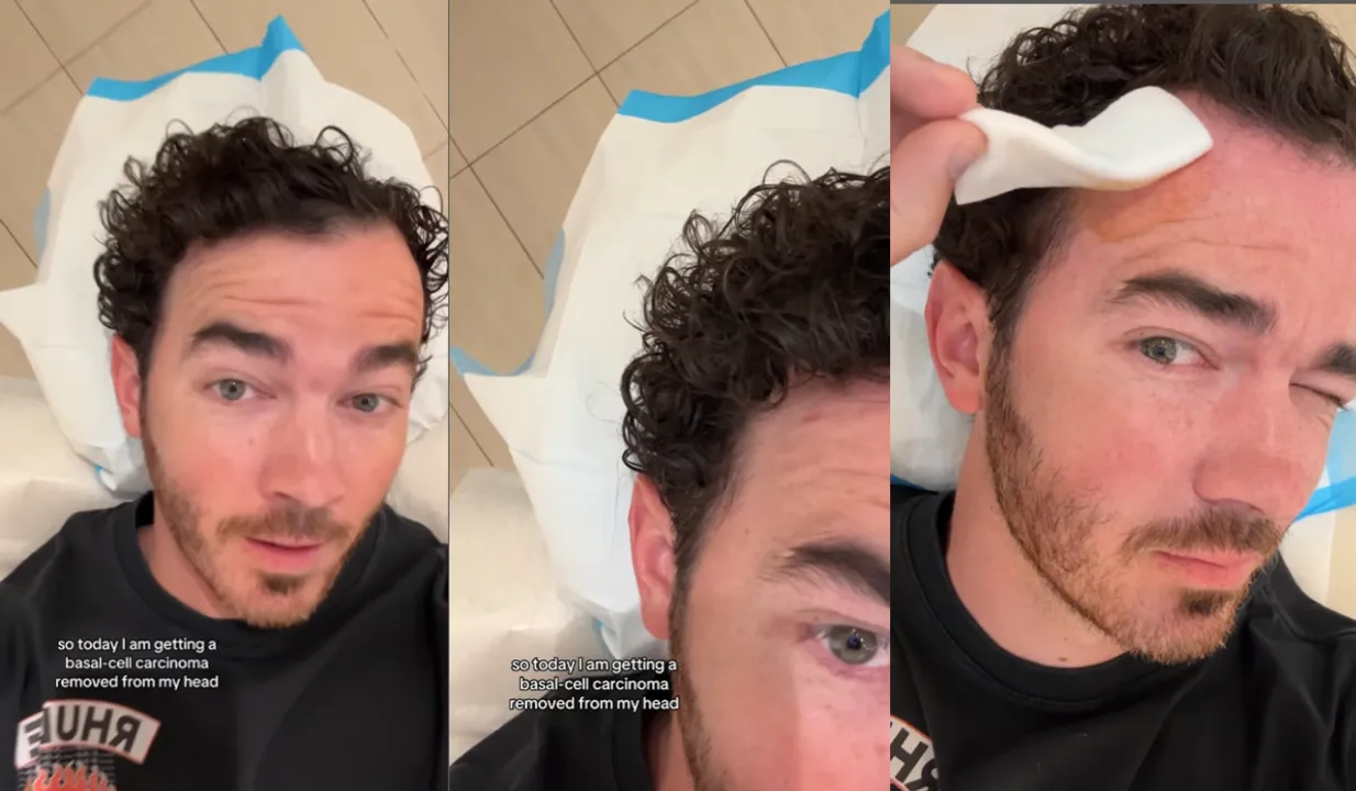 'Get Your Moles Checked': Kevin Jonas Shares Skin Cancer Diagnosis