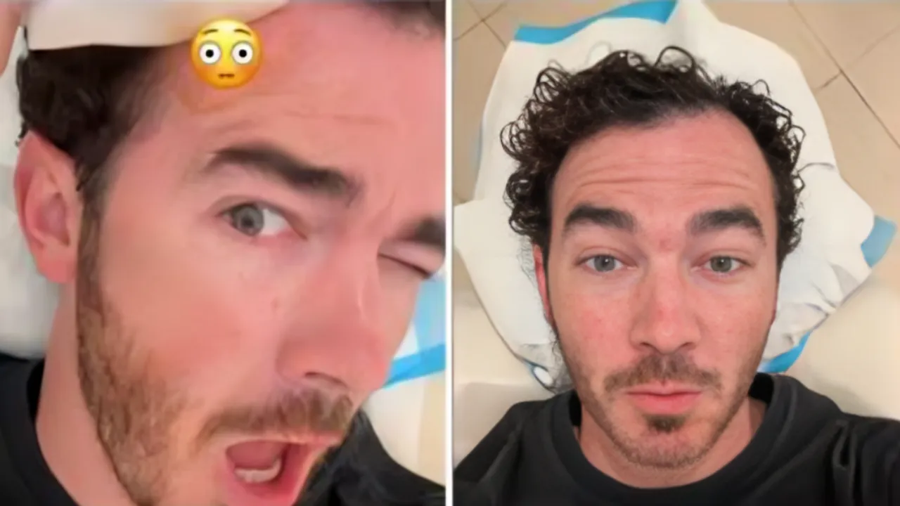 Kevin Jonas Has Basal Cell Carcinoma; What You Must Know About This Skin Cancer
