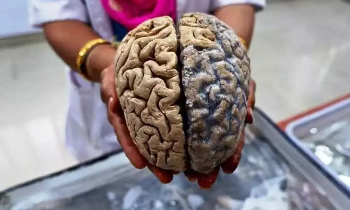  New study reveals how brain reacts to death