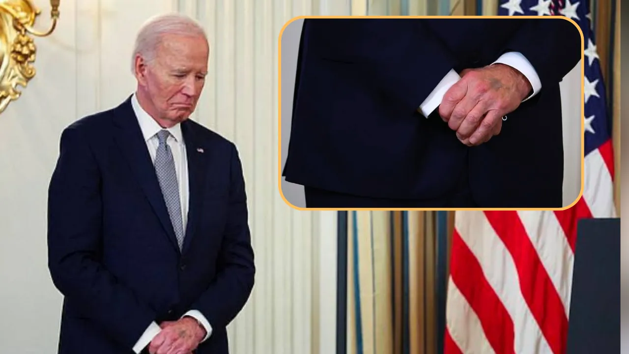 Watch Joe Biden's mysterious purple bruise sparks speculation online