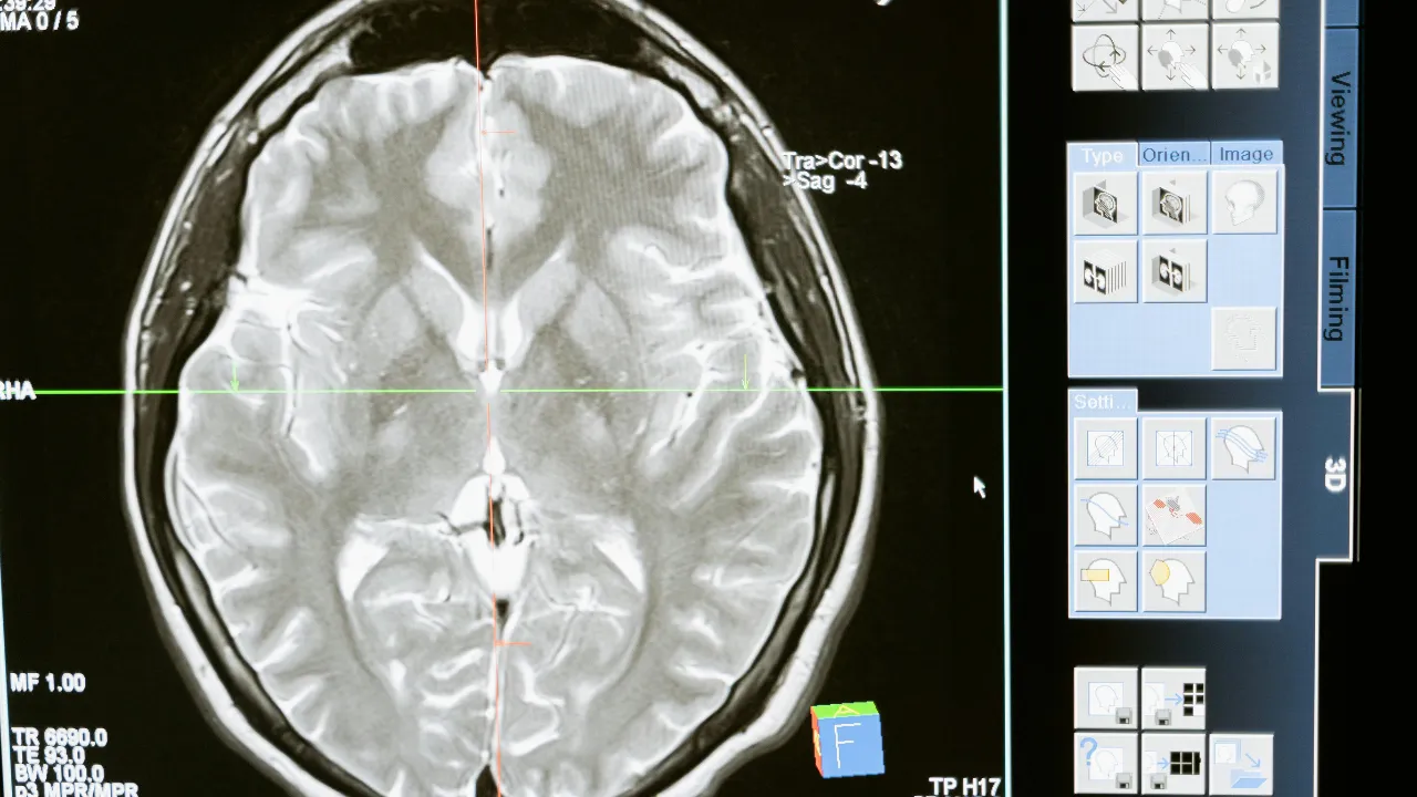  Representative image of brain Photograph: (Pexels) 