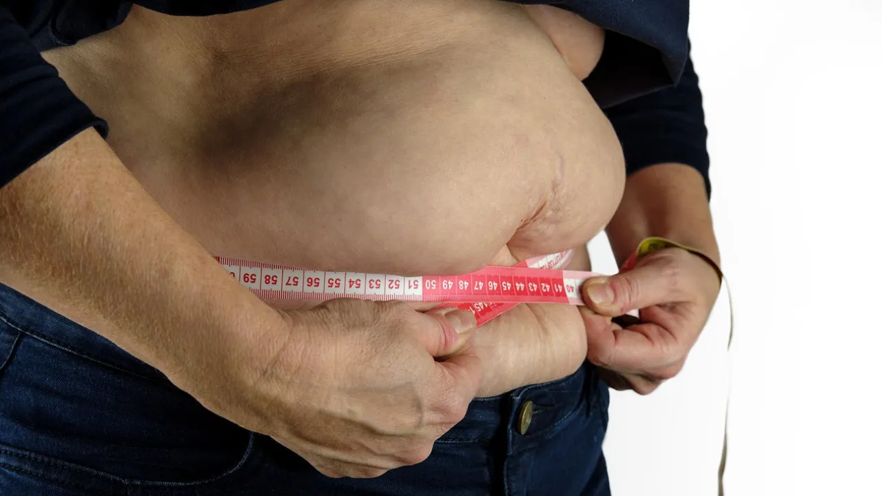  Obesity is a complex and multifaceted health issue that affects millions of people worldwide. Photograph: (Pixabay) 