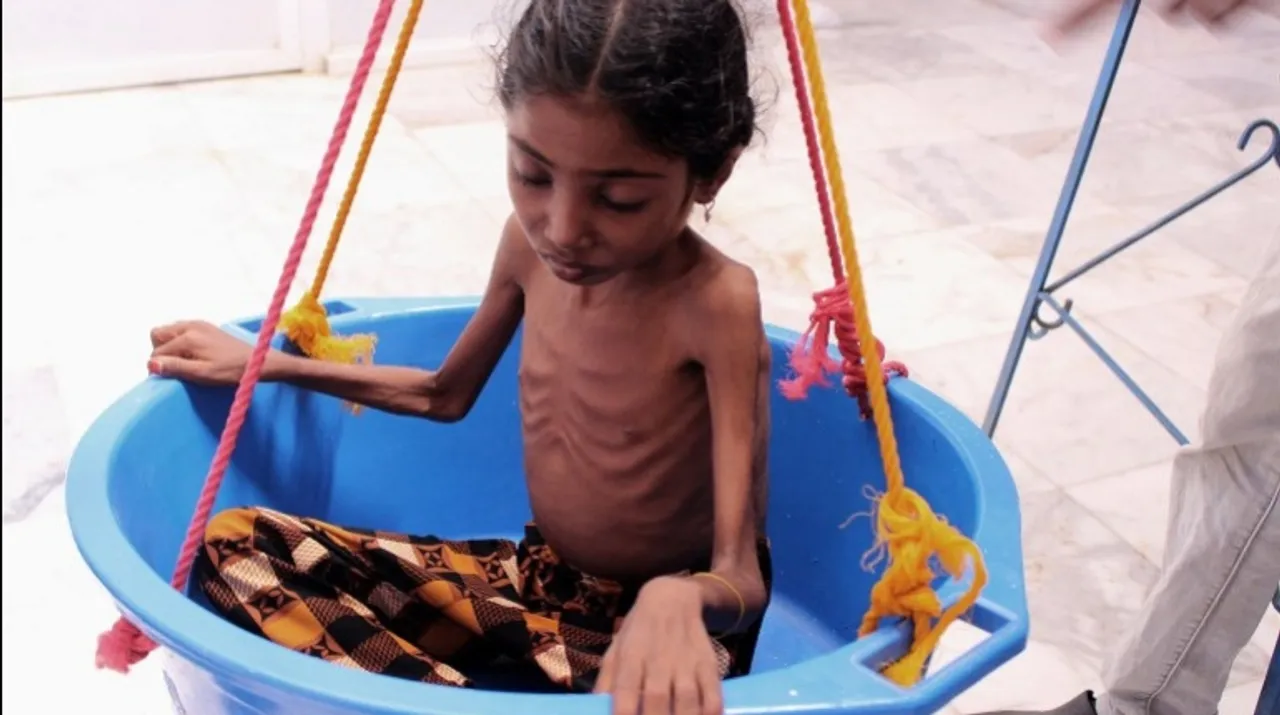  A Yemeni child suffering from severe malnutrition is weighed at a treatment centre in a hospital in Yemen's northwestern Hajjah province. Photograph:(AFP) 