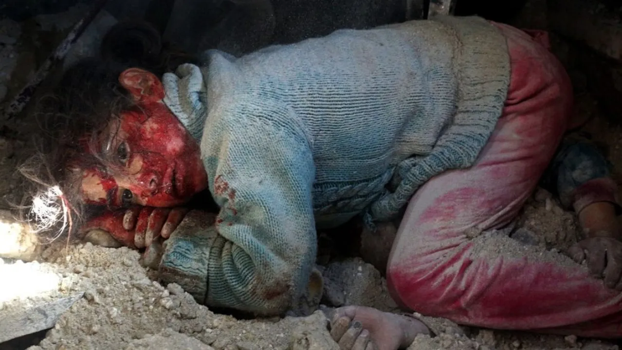  Wounded Syrian girl awaits rescue  Photograph:(AFP) 