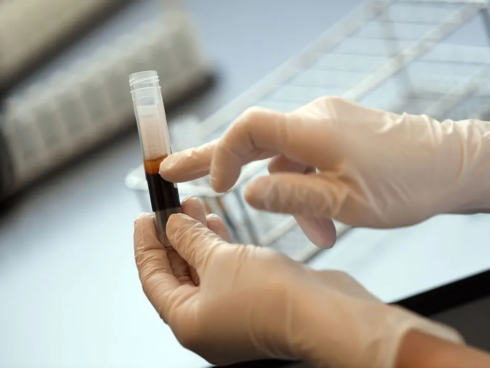  Convalescent Plasma Therapy Photograph:(PTI) 
