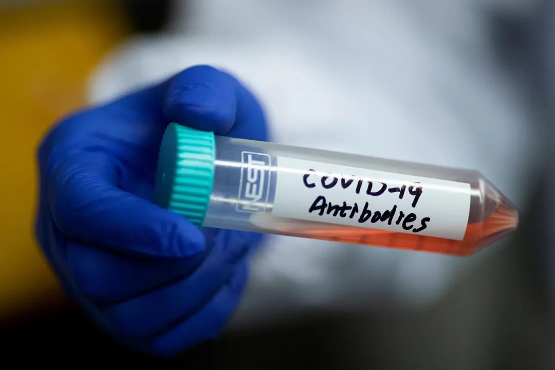  Coronavirus antibodies Photograph:(Reuters) 