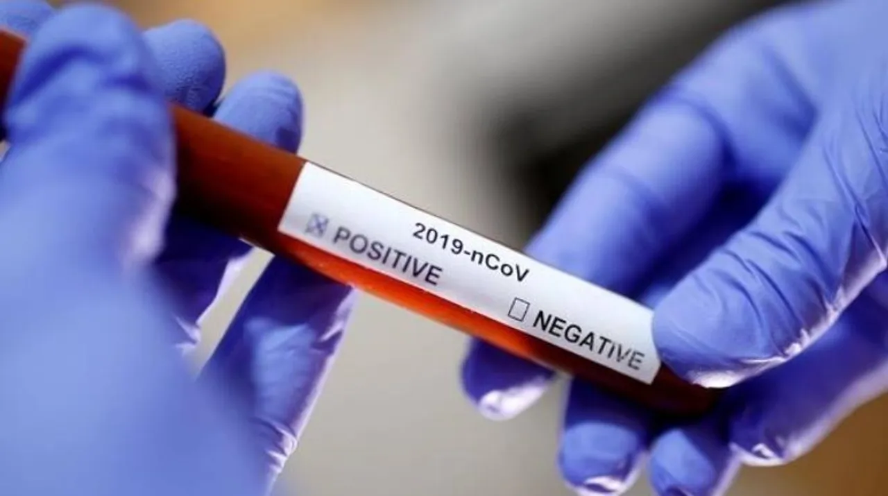  Rapid antigen tests  Photograph:(Reuters) 