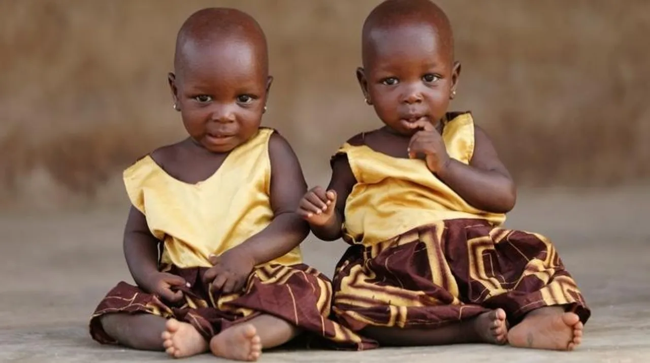  Identical twins Photograph:(Reuters) 