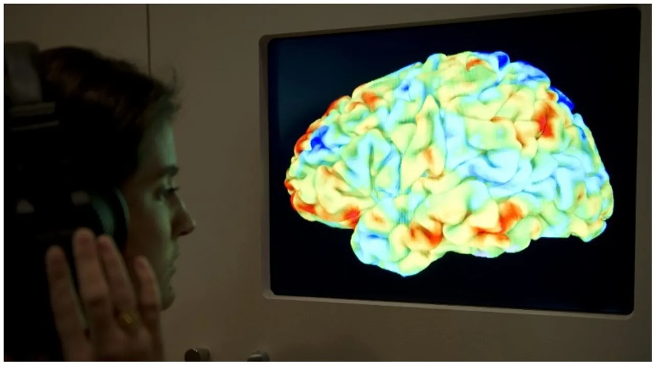  Human brain Photograph:(AFP) 