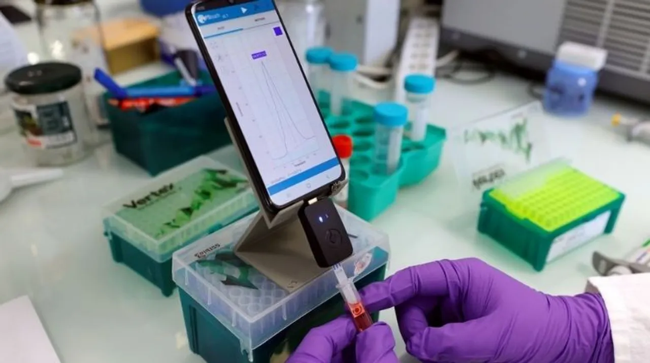  A team of scientists in the US has developed a highly sensitive Covid test, which relies only on low-tech kit and a smartphone (representative image).  Photograph:(Reuters) 