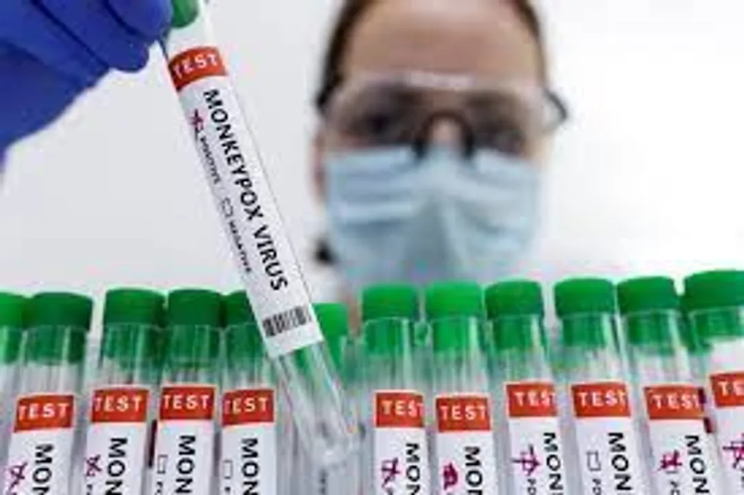  Delhi reports fifth case of Monkeypox Photograph:(Reuters) 