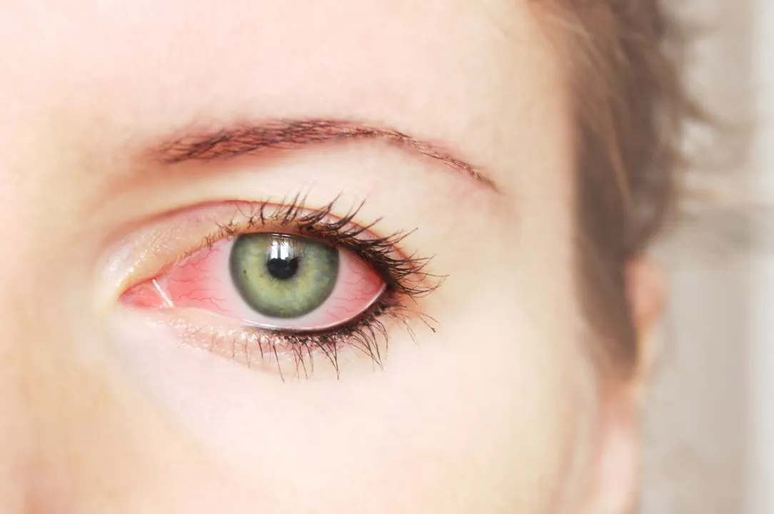  Eye syphilis is a rare occurrence, affecting only a small percentage of cases Photograph:(Agencies) 